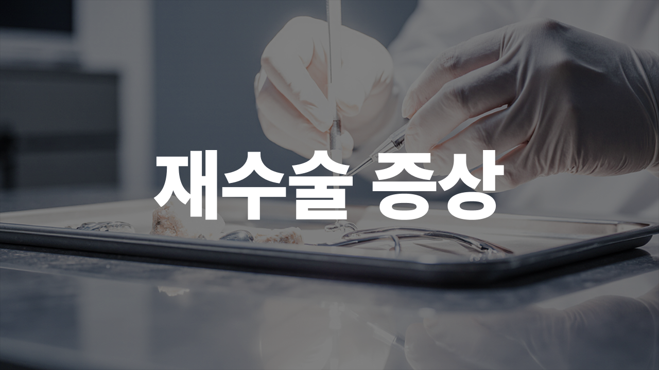 임플란트 재수술이 필요한 4가지 증상