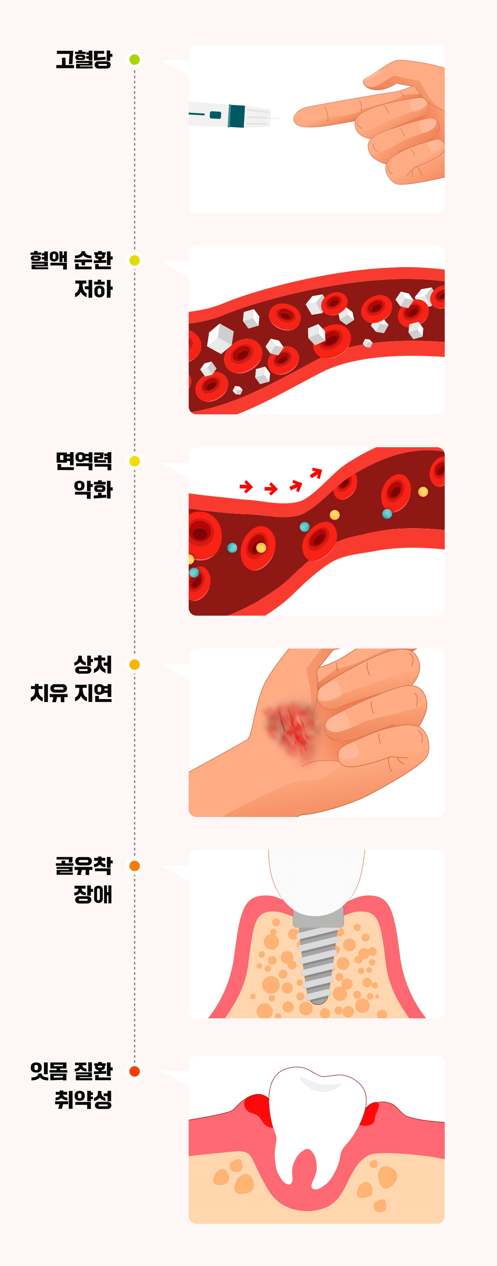 당뇨와 임플란트의 관계를 나타낸 인포그래픽