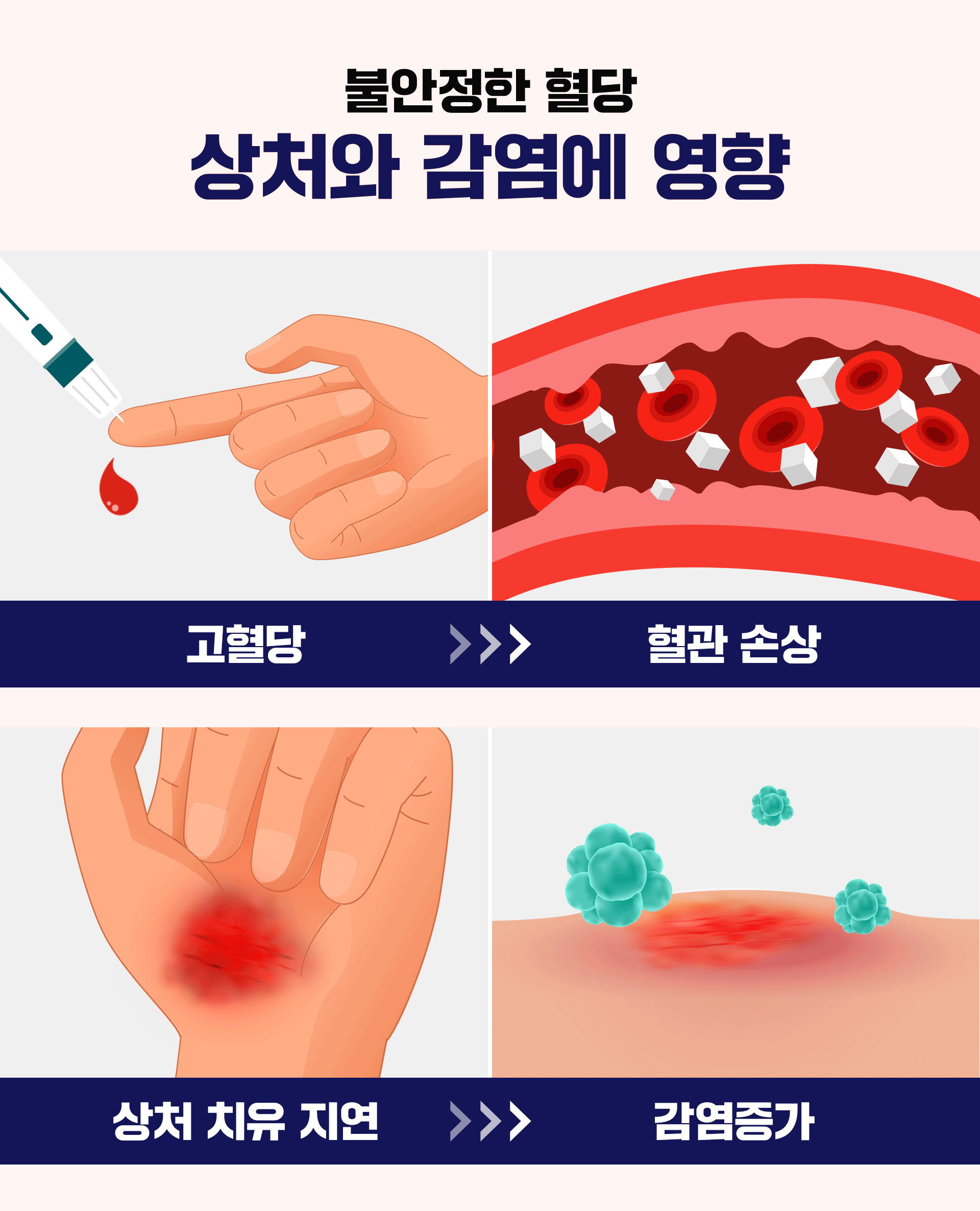 불안정한 혈당이 상처와 감염에 미치는 영향을 나타낸 이미지
