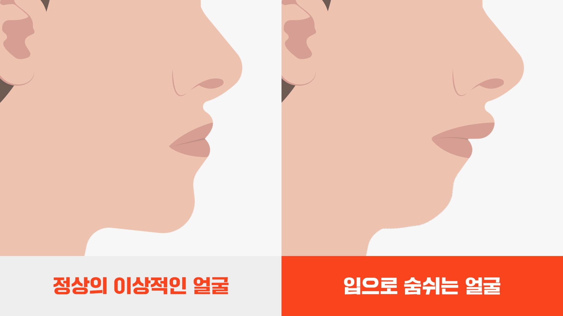 부정교합으로 인한 호흡과 얼굴형의 변화를 표현한 이미지