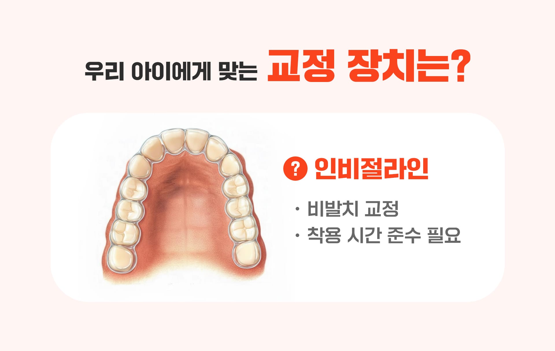 성장기 교정 아동에게 맞는 교정장치를 표현한 세 번째 인포그래픽