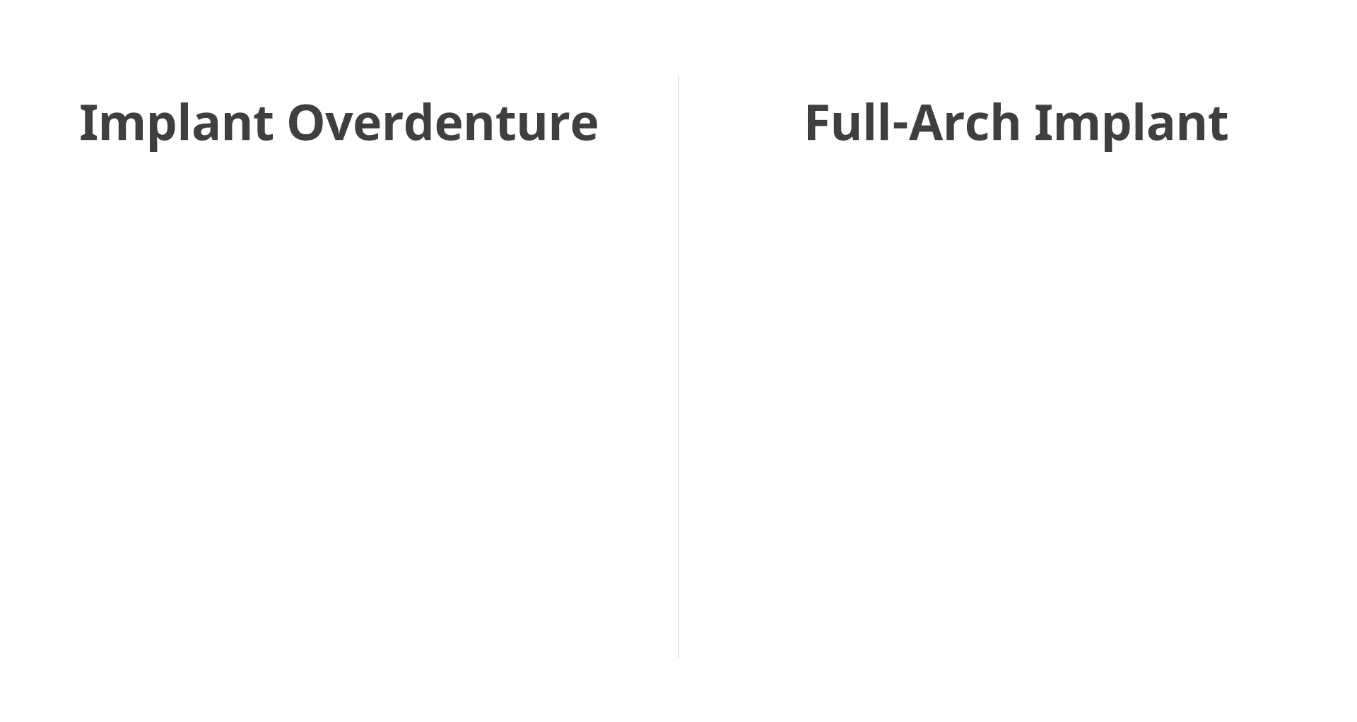 임플란트 틀니와 풀아치 임플란트의 저작력 차이를 비교한 인포그래픽 