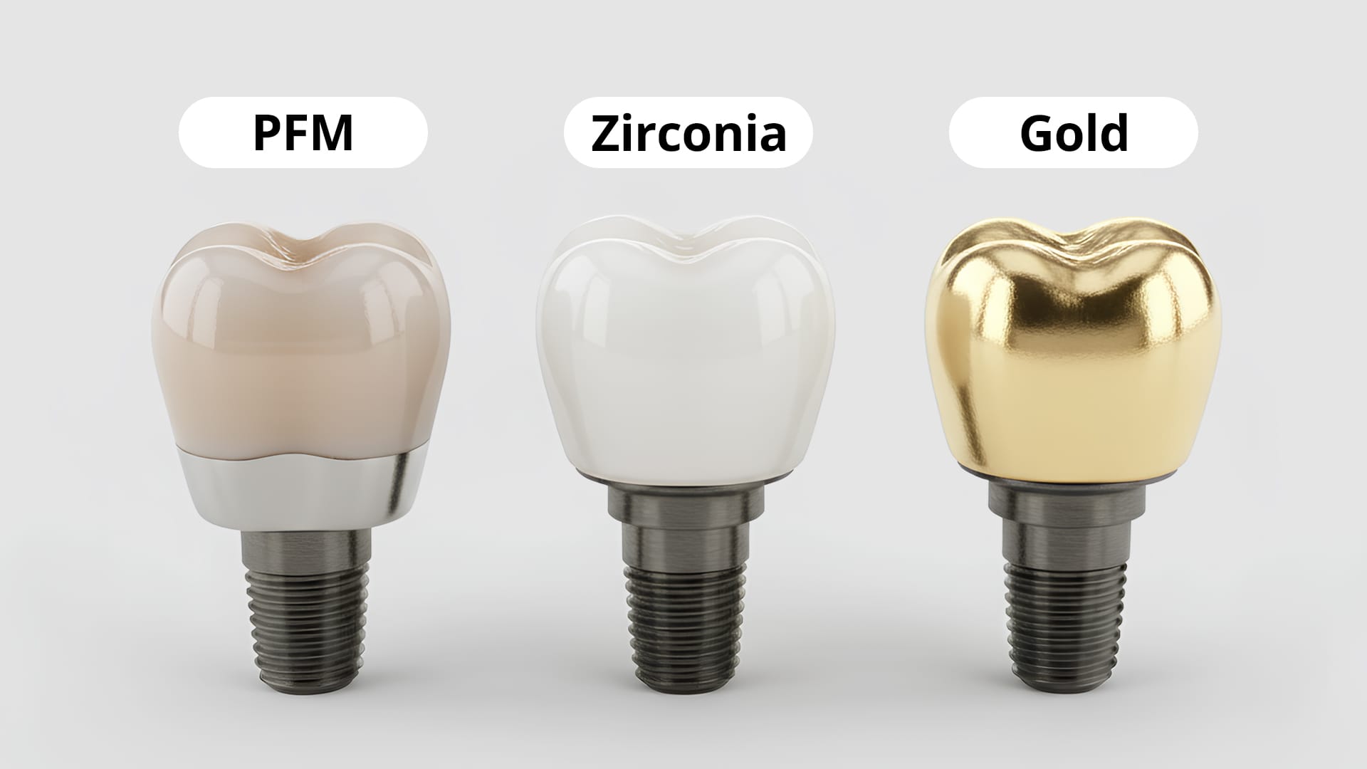 임플란트 크라운 종류 - PFM, Zirconia, Gold