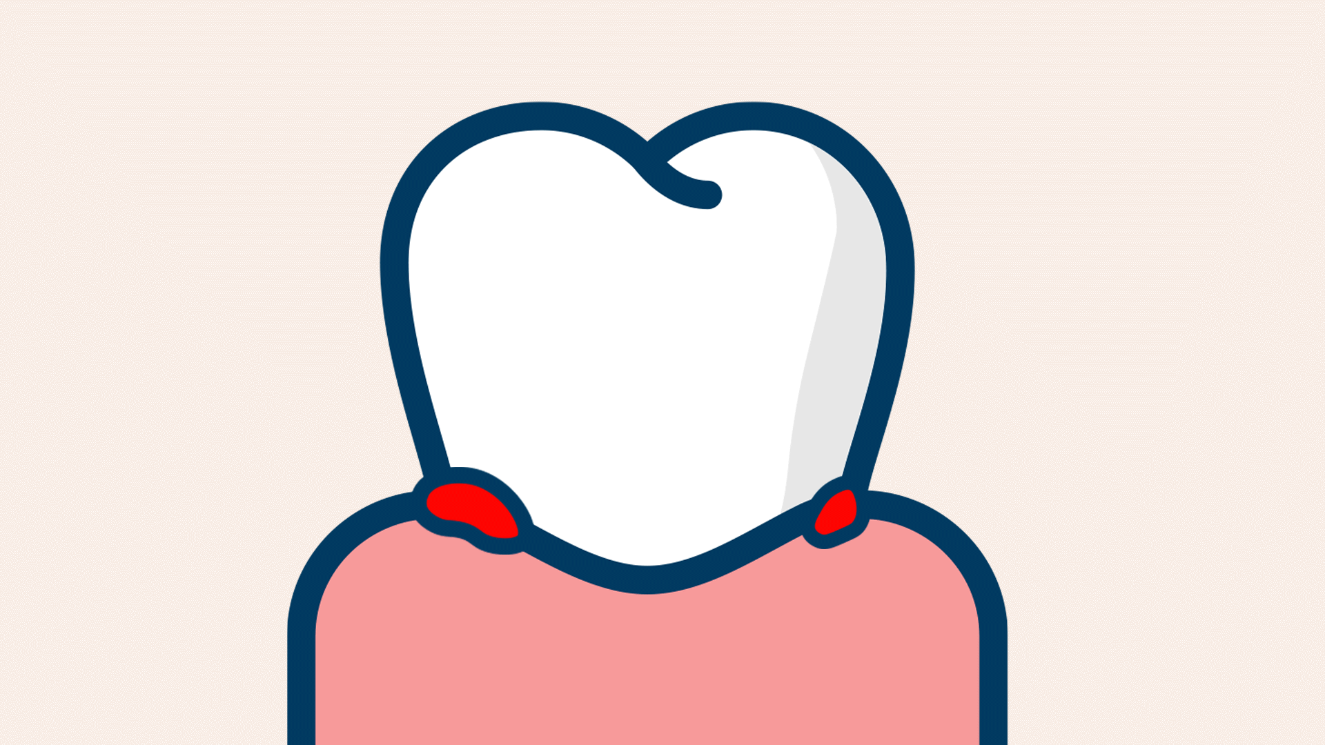 임플란트 주변 잇몸이 자꾸 붓고 양치할 때마다 아픈 경우