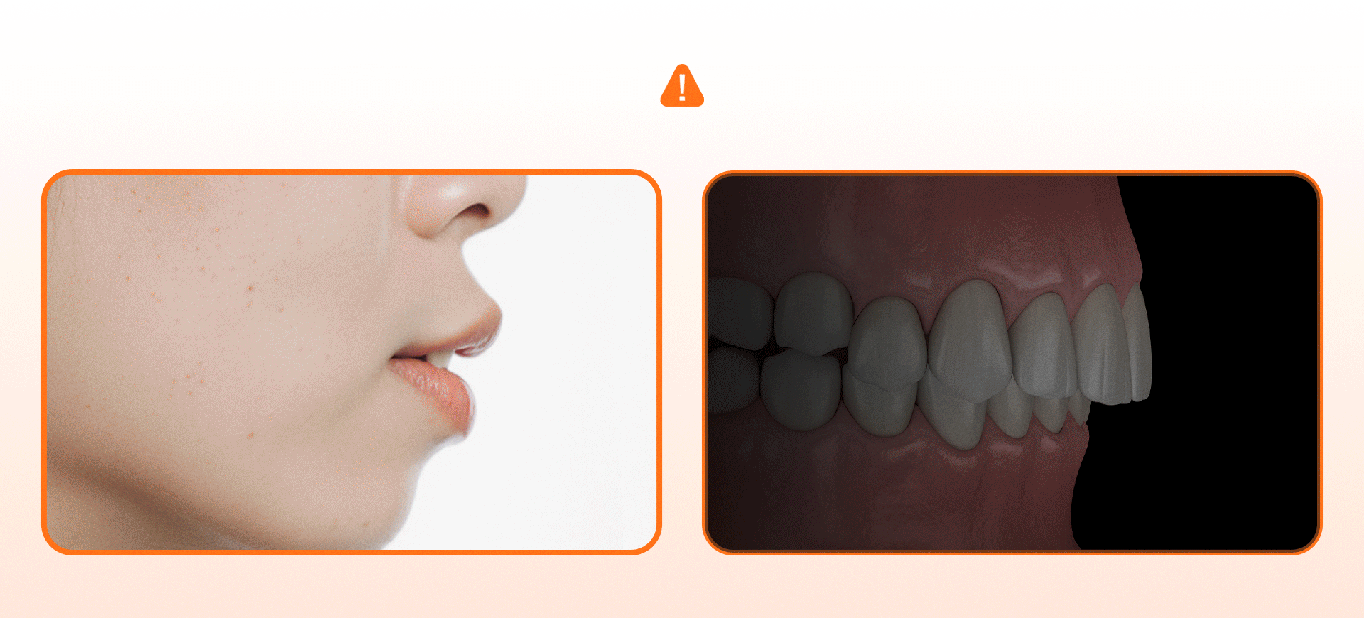 돌출입과 과개교합을 표현한 의학적 일러스트 