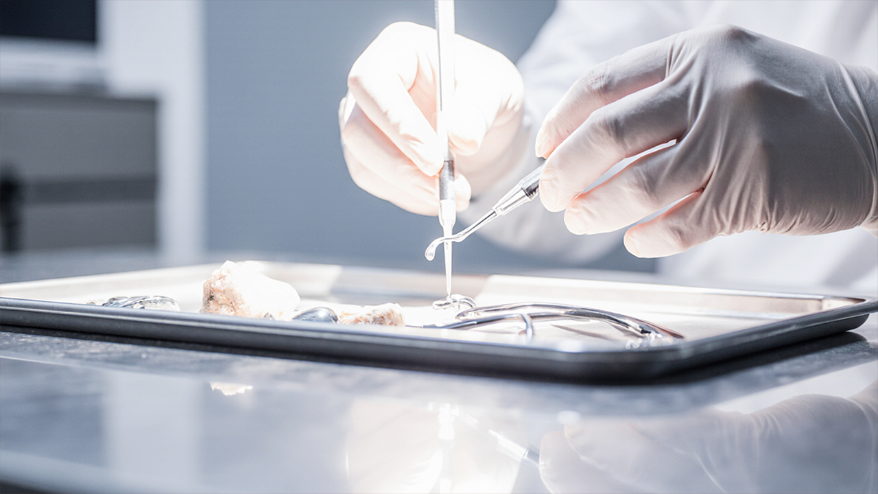 임플란트 재수술이 필요한 4가지 증상