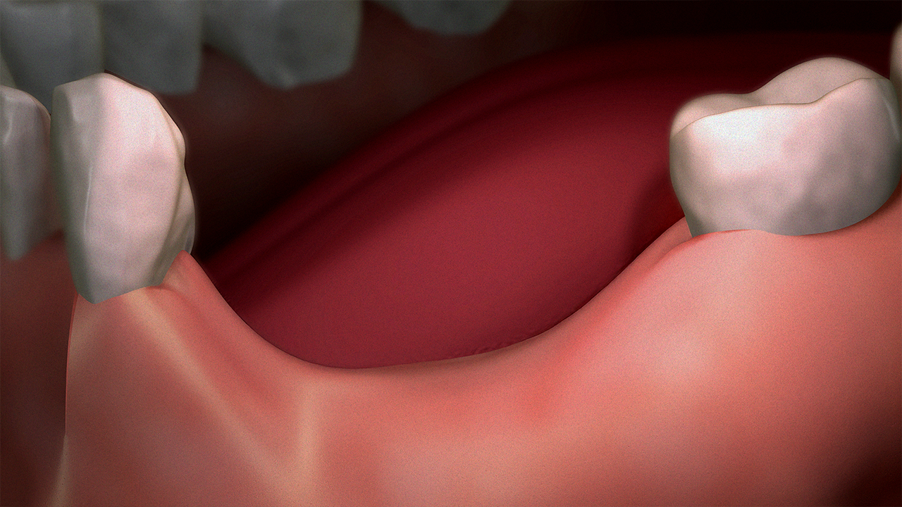 If Your Denture Feels Loose, Read This First