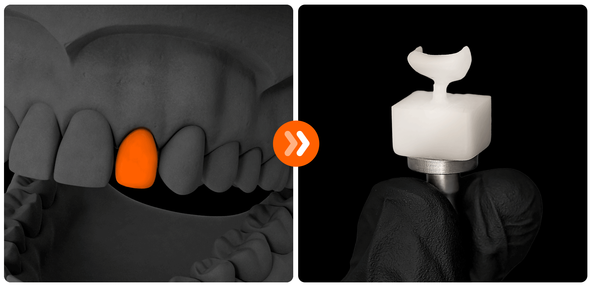 An image showing the digital process of designing and fabricating laminate prosthetics using CAD (3D scan data checking) and CAM (precision milling) equipment