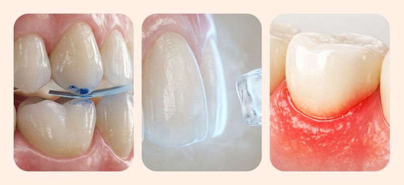 Visual guide to the 3 critical safety checks performed during a Buffer Day before flying home after veneer treatment.