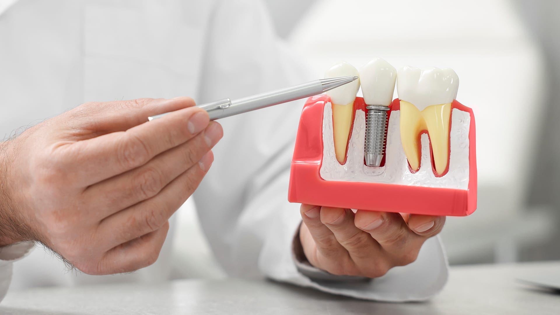 의료진이 임플란트 모형을 들고 환자에게 설명하는 모습