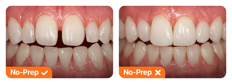 Split image comparing sufficient dental space versus insufficient space for procedures.