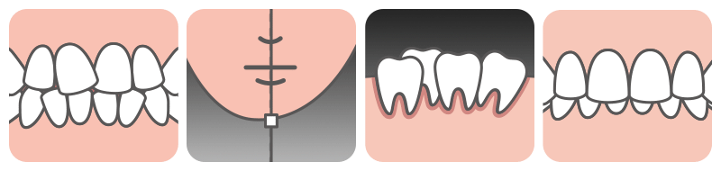 ※ The copyright for all content on this blog belongs to medihi. Unauthorized copying, distribution, or derivative use is strictly prohibited, and violations may result in legal action without prior notice.