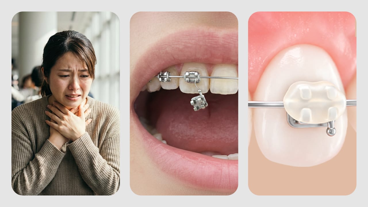 Dealing with Orthodontic Emergencies Abroad: The Traffic Light System for Immediate Action