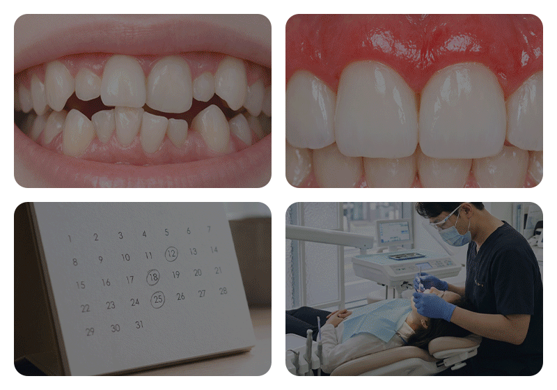 An image visually representing four variables that affect the duration of orthodontic treatment.