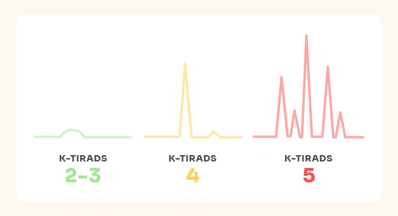 K-TIRADS 등급에 따른 위험도와 암 의심 정도의 상승을 시각화