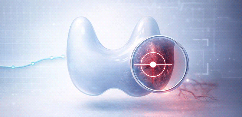 겉으로는 얌전해 보이는 갑상선암이지만, 의학적 모니터링 하에 철저히 관리되고 있는 상황을 시각화