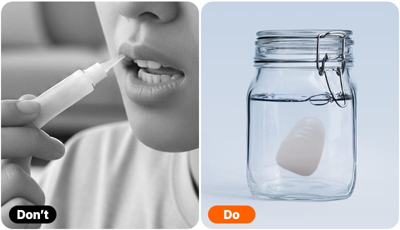 Image demonstrating strictly prohibited actions and the correct emergency steps to take if a veneer becomes damaged or detached.