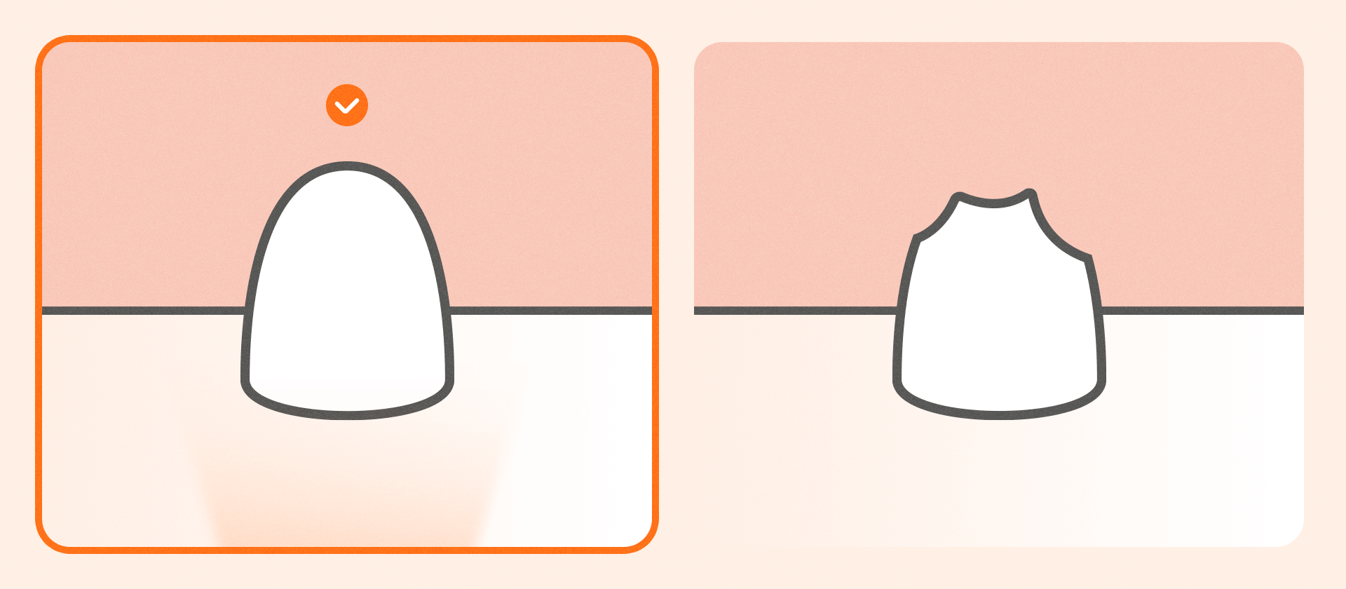 An infographic illustrating the difficulty of intraoral scanning based on the position of the tooth-gum margin.
