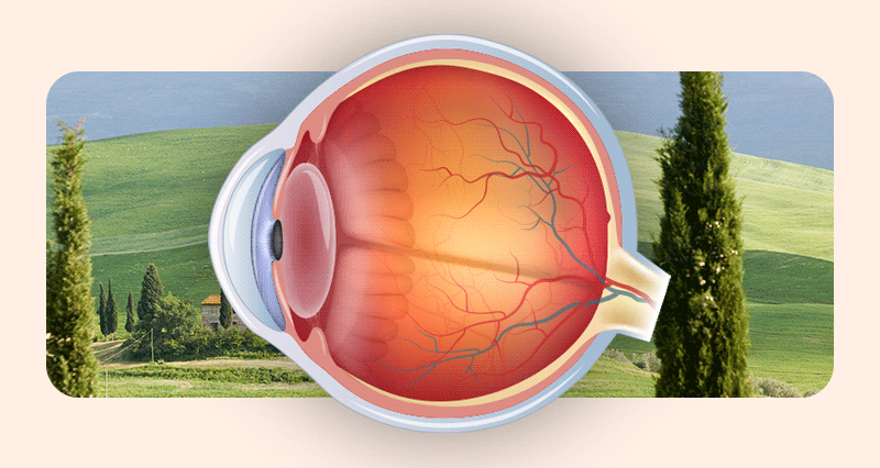 A visual comparison showing both lens opacity and blurred vision when a cataract develops.
