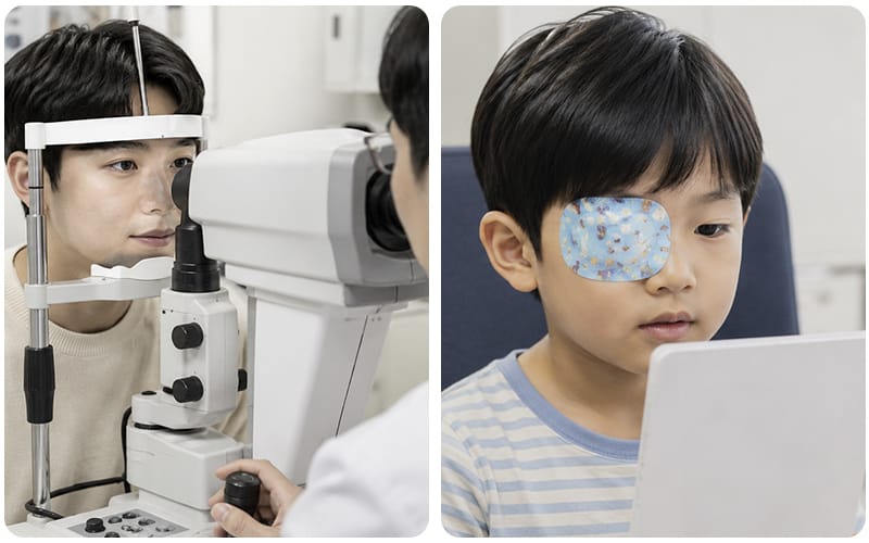 A comparative visual showing the differences in treatment and management approaches for traumatic cataracts between adults and children