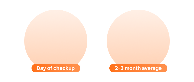 An illustration comparing the difference between fasting blood glucose and HbA1c