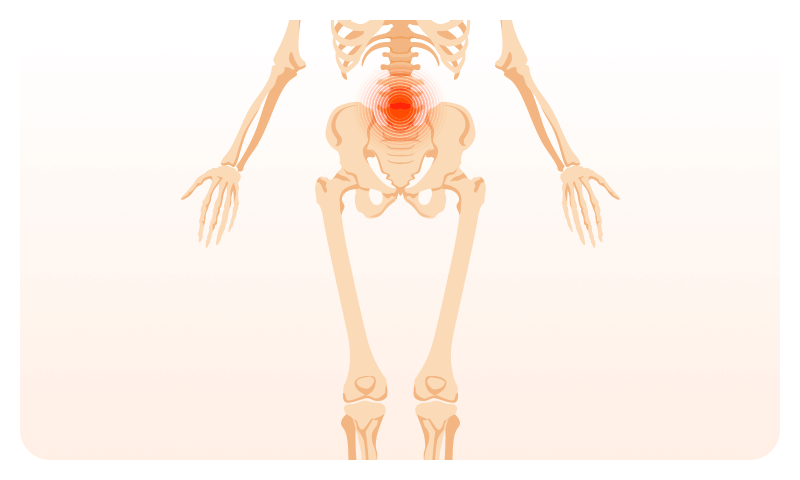 An illustration showing back pain radiating down to the leg