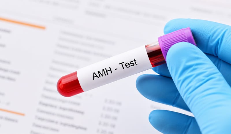 A blood sample being drawn for an AMH (anti-müllerian hormone) ovarian reserve test