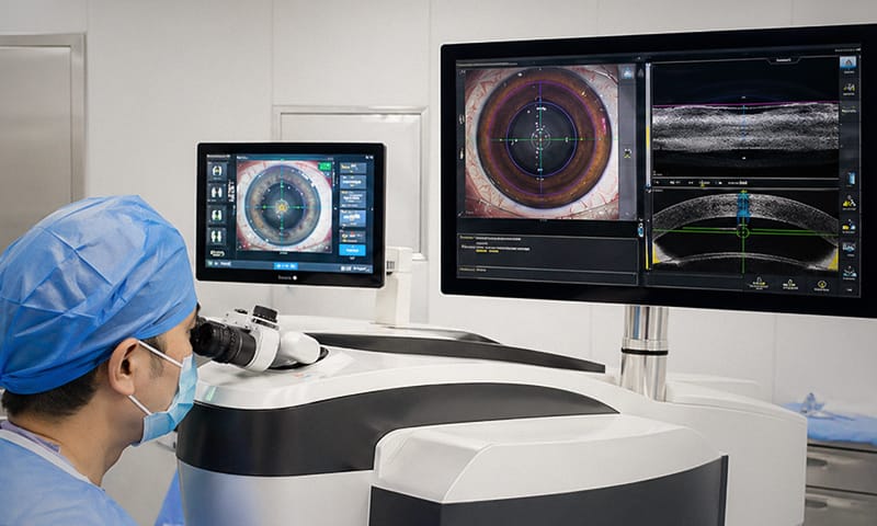 A cataract surgery being performed using a femtosecond laser