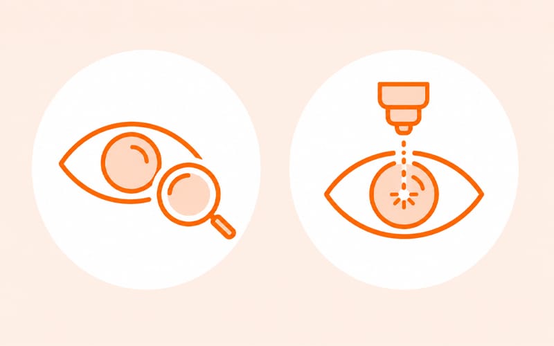 An infographic showing test-based monitoring versus YAG laser capsulotomy treatment