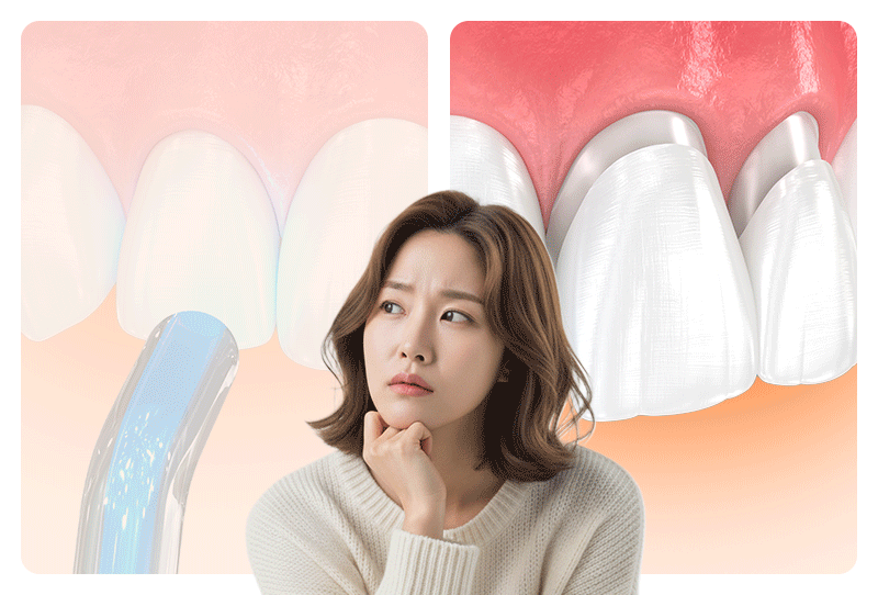 레진과 라미네이트 시술 사이에서 고민하는 사람