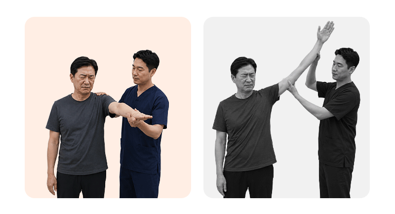 An illustration comparing the mobility differences between frozen shoulder and rotator cuff pain