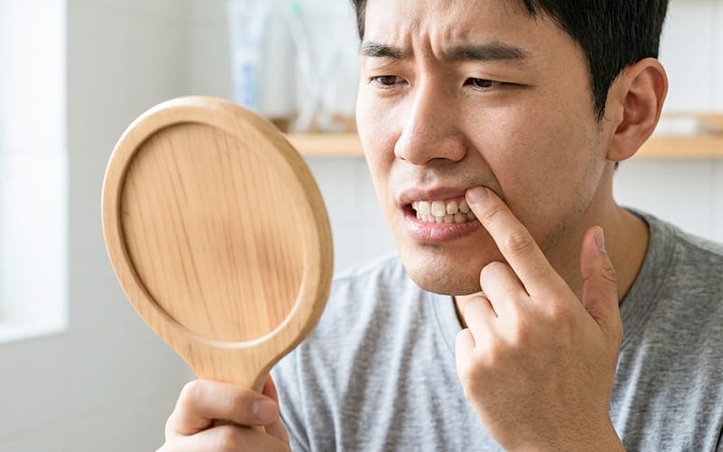 A young adult inspecting enamel demineralization on their teeth in a mirror with concern.