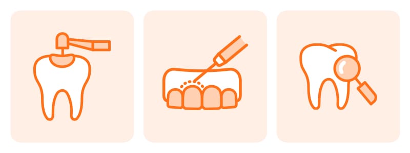 An infographic displaying 3 key tooth-preserving techniques used during veneer removal