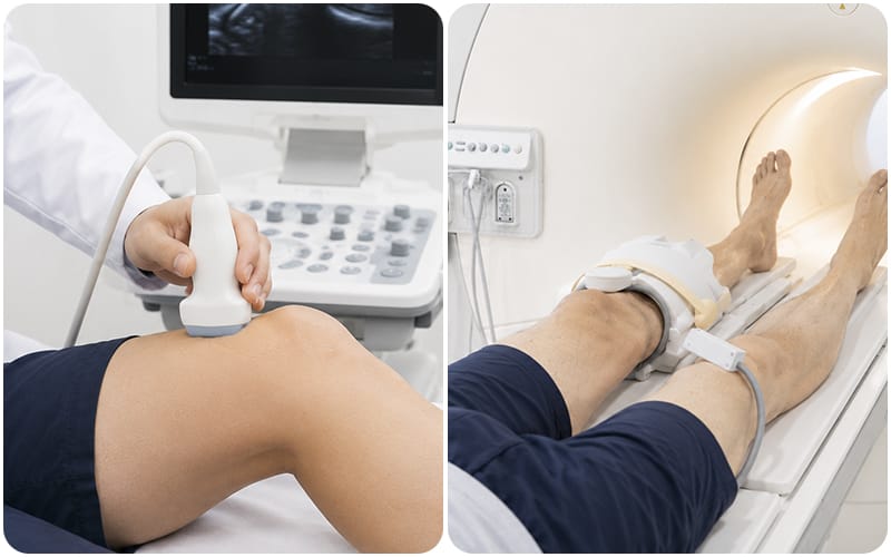 An image comparing joint ultrasound and knee MRI scan results