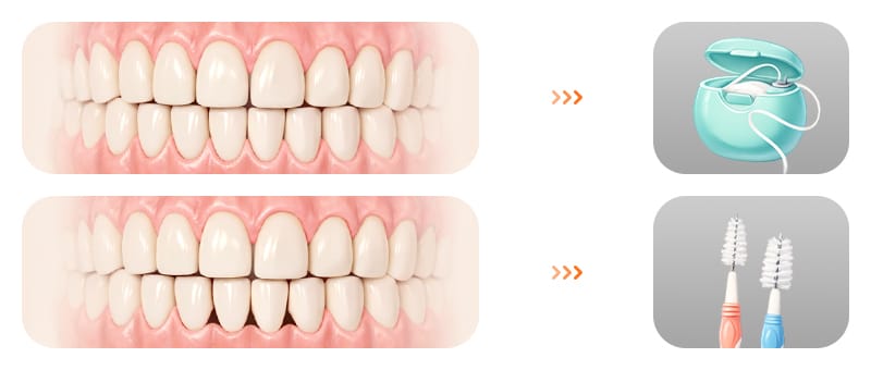 An infographic comparing recommended oral care tools tailored to different dental conditions