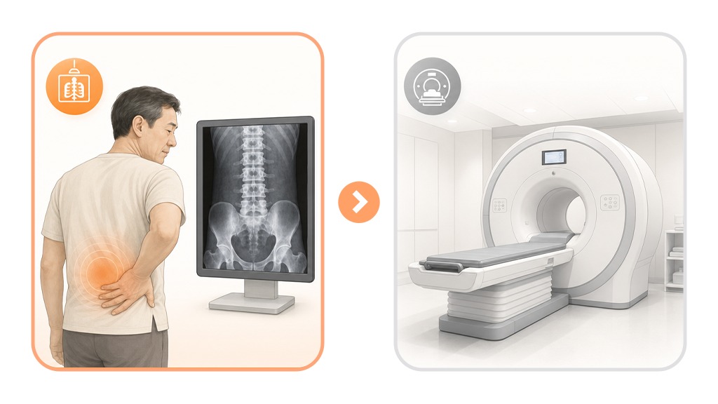단순 요통에는 MRI 보다는 기본 검사(엑스레이)를 먼저 받아야 함을 나타내는 인포그래픽