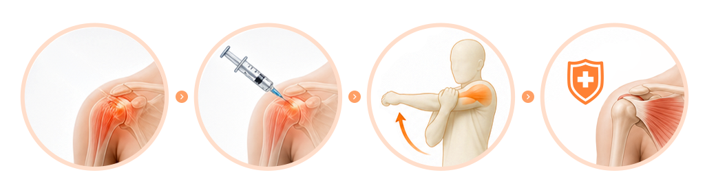 An infographic showing the importance of post-injection rehabilitation therapy for shoulder health