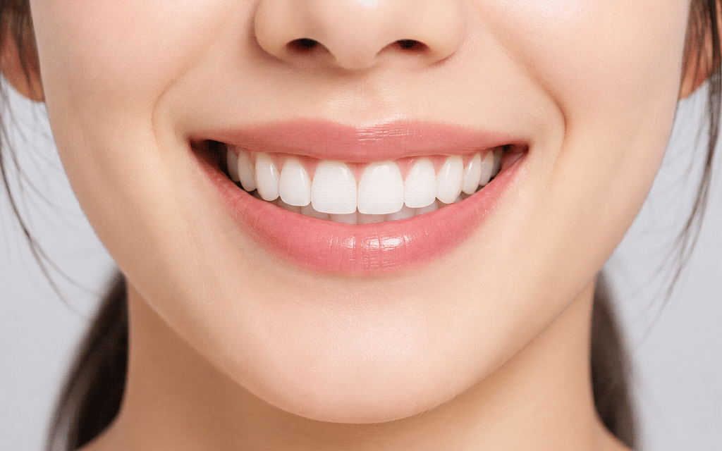Smile Arc Design Guidelines: Creating a Smile in Harmony with the Lower Lip