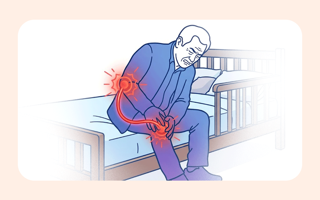 An illustration showing that knee pain can originate from lumbar spine nerves
